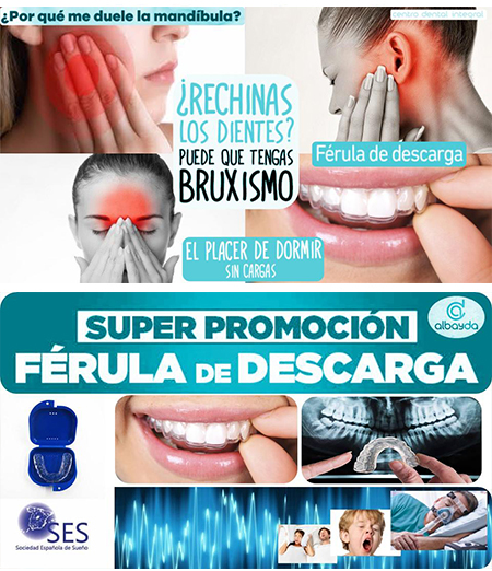 Nuevas férulas dentales para el tratamiento del bruxismo - Clinica dental  Gallego Experiencia Dental